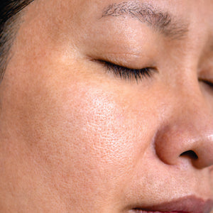 Close-up of a person's face with visible skin texture